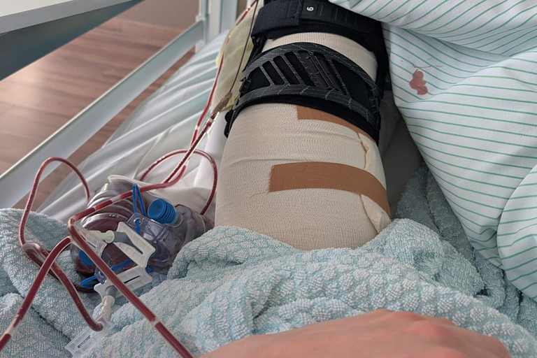 Das linke Knie von Werkstetter nach der Operation
