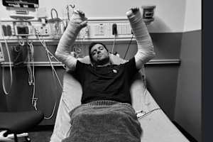 Anthony Bourdon brach sich in den USA beide Arme