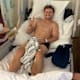 Schwer gestürzter Tarran Mackenzie: So geht es dem Ducati-Privatier