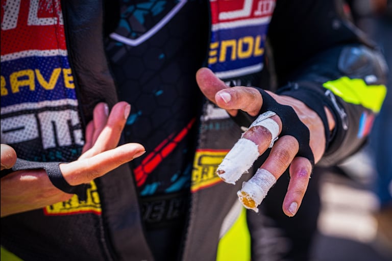 Schlimmer Finger bei Stepan Zuda