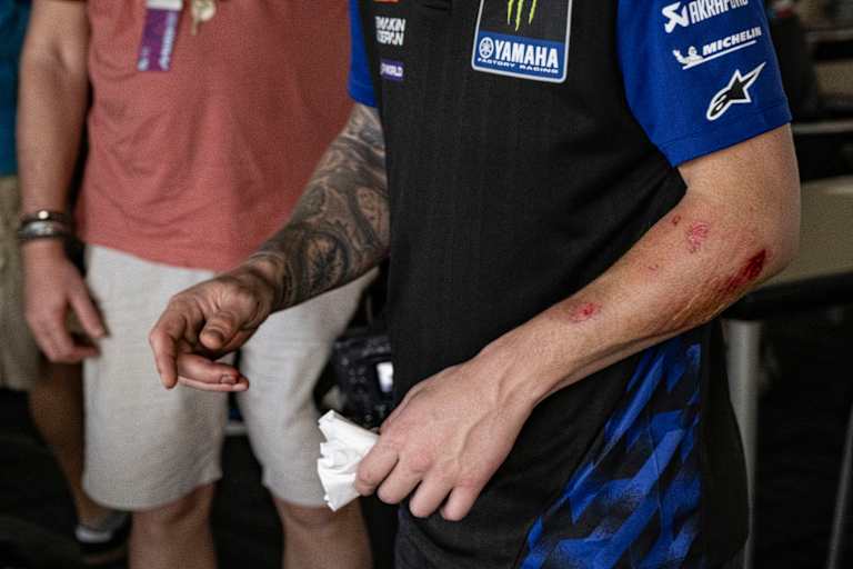 Fabio Quartararo trug von seinem Crash einige Spuren davon