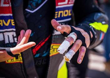 Schlimmer Finger bei Stepan Zuda