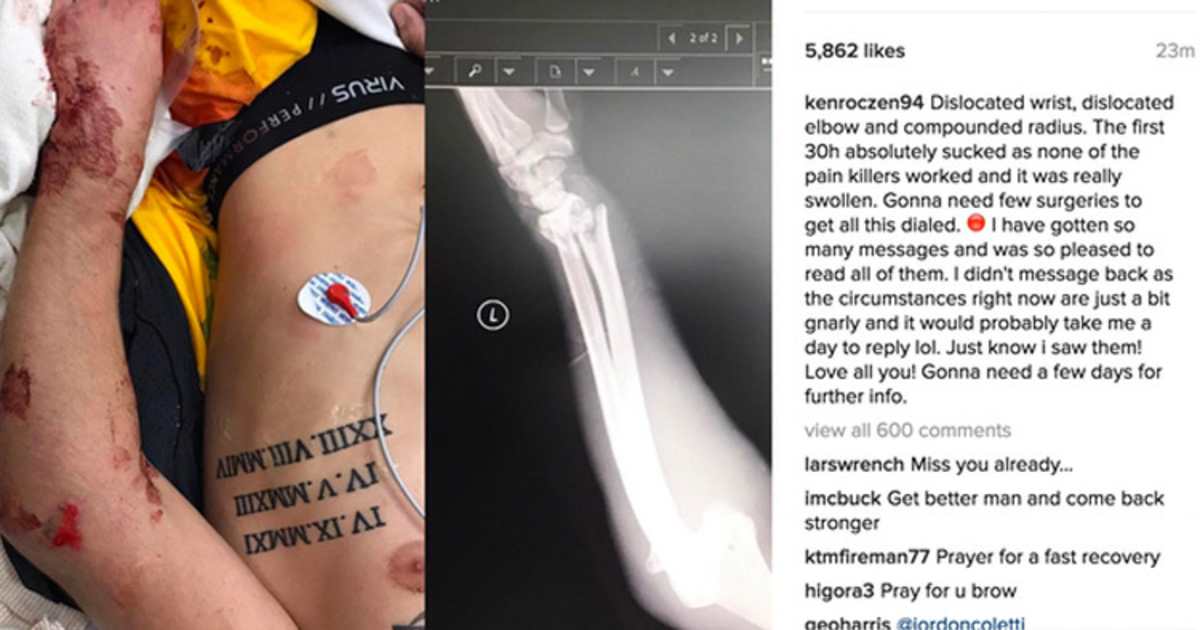 Ken Roczen nach Crash: Verletzungen schlimmer als befürchtet - US ...