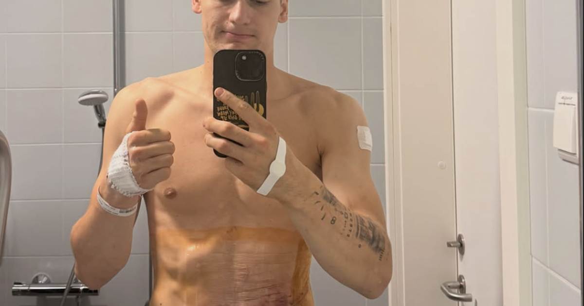 Ducati-Werksfahrer-Andrea-Bonacorsi-Fu-raste-riss-seine-Bauchdecke-auf