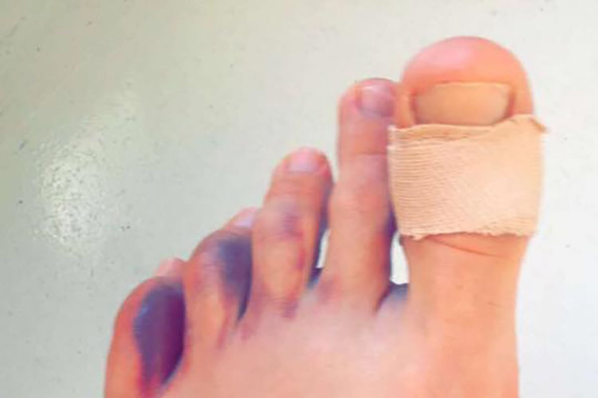 Aegerter hat Schmerzen in seinem linken Fuß und im Rücken