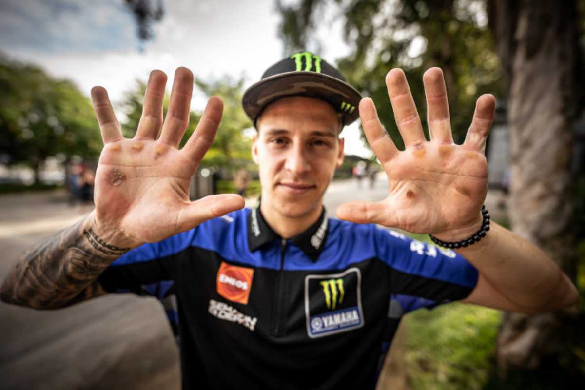 «Signs – Zeichen»: Fabio Quartararo mit seinen geschundenen Händen beim Wintertest in Sepang. Schon damals sagte der Gesichtsausdruck alles – 2023 wurde er mit Yamaha nicht glücklich