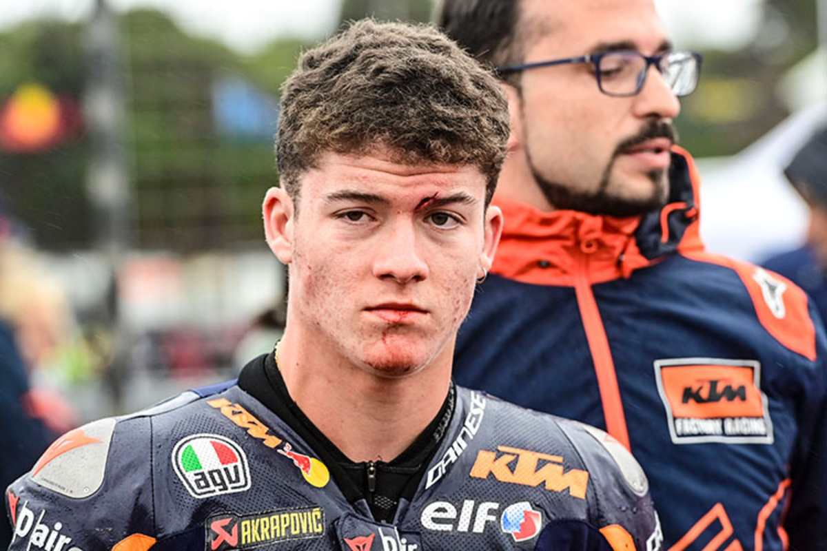 Daniel Holgado: Schon vor dem Start Blutspuren im Gesicht