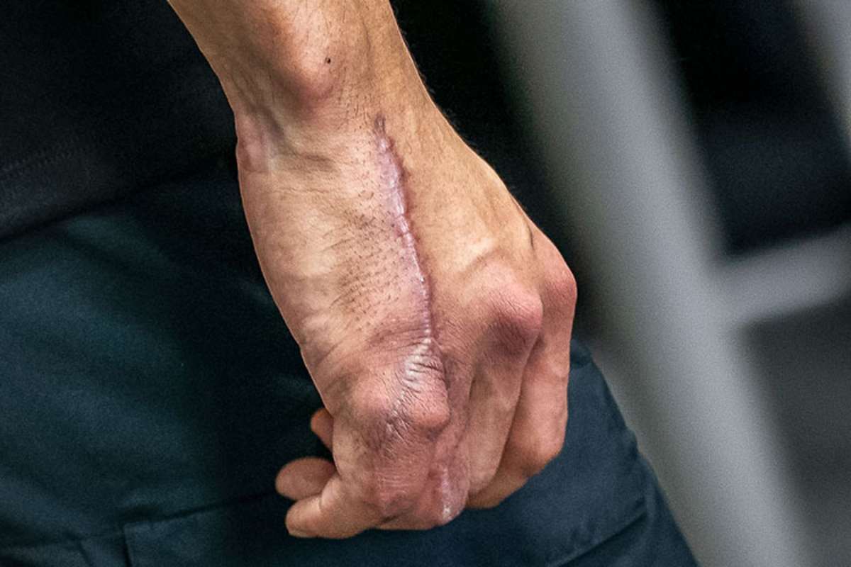 Taka Nakagami: Die Verletzung hat ihre Spuren hinterlassen