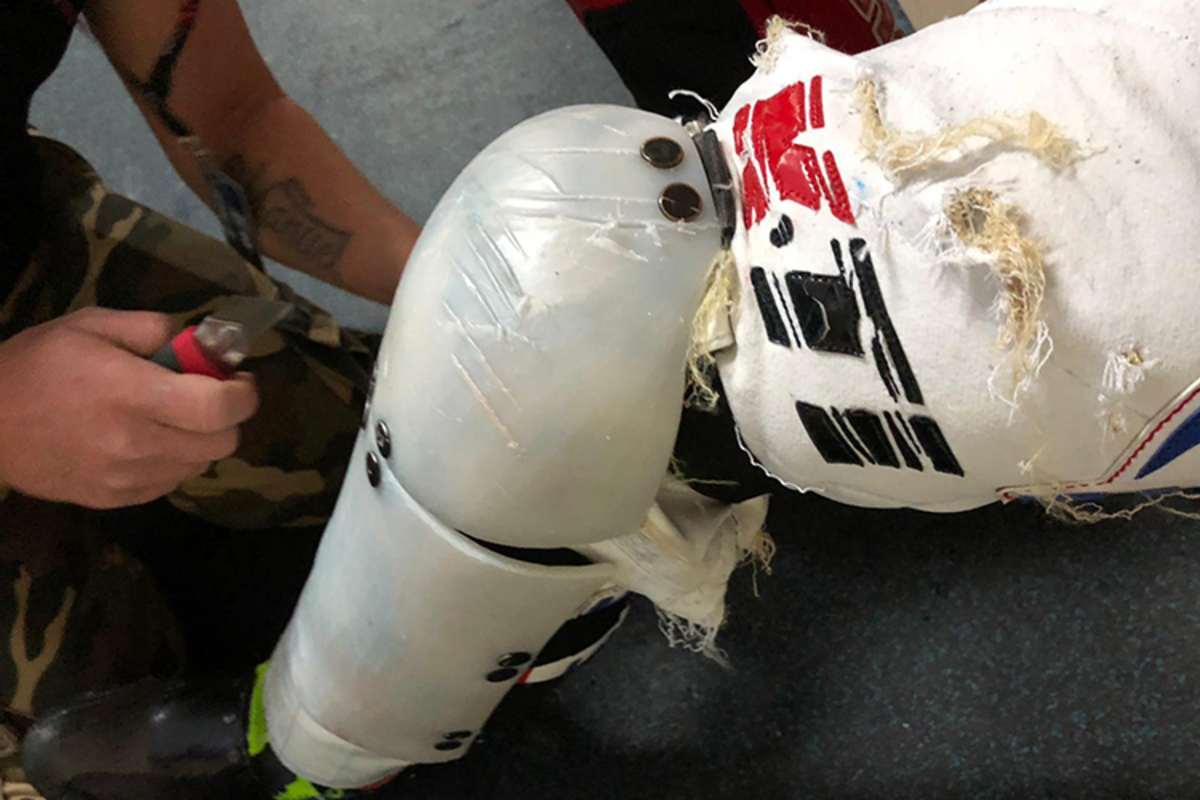 Das linke Bein von Franz Zorn wurde übel zugerichtet