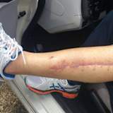 Gabor Talmacsi: Die Wunden sind fast verheilt