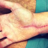 Die Hand von Alexander Lundh