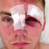 Harry Stafford hat es in Imola schwer erwischt