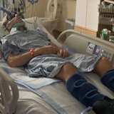  Killian Auberson ist in den USA schwer gestürzt und hat nach einem Wirbelbruch Lähmungserscheinungen