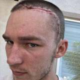 Austin Forkner nach seiner Kopf-Operation