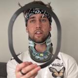 Marcel Stauffer: Nach 12 Wochen durfte der Fixateur weg.