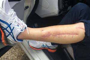 Gabor Talmacsi: Die Wunden sind fast verheilt