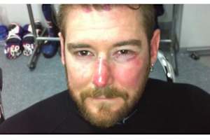 Damian Cudlin: Böser Abflug in Japan