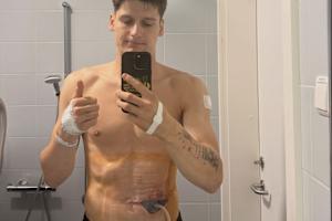 Andrea Bonacorsi meldete sich aus dem Krankenhaus