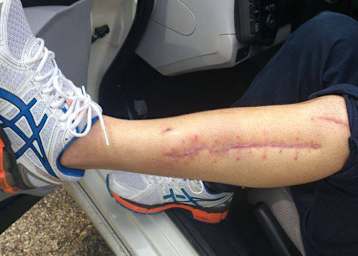 Gabor Talmacsi: Die Wunden sind fast verheilt