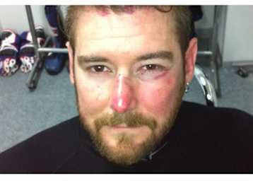 Damian Cudlin: Böser Abflug in Japan