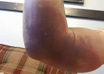 Der Arm von Jimmy Olsen