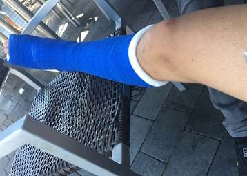 Jonas Geitner hat ein Gips-Bein