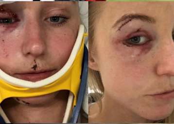 Ihr Arai-Helm verhinderte noch Schlimmeres bei Ilse de Haas