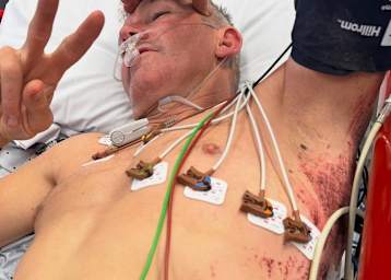 Troy Bayliss hatte bei seinem Unfall viel Glück