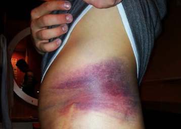 Richard Speiser sieht wie verprügelt aus