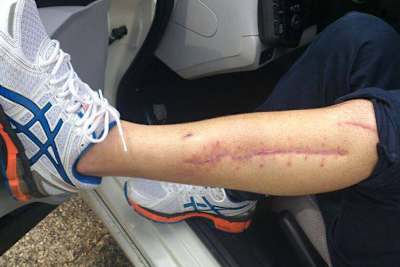 Gabor Talmacsi: Die Wunden sind fast verheilt