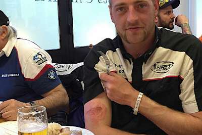 Gangl zeigt seinen lädierten Oberarm