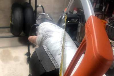 Michael Dunlop: Der Gips muss ab