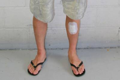 Domi Aegerter musste sich nach dem Moto2-Motorschaden vom Dienstag am linken Unterschenkel nähen lassen