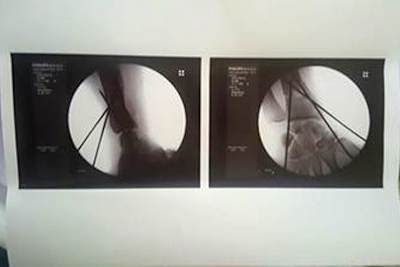 Ein Arm von Mathieu Gines