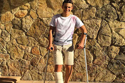 Kürzlich wurden die Schrauben aus Quartararos gebrochenem Knöchel entfernt