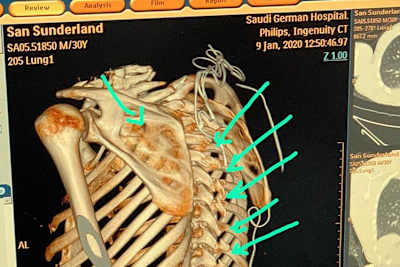 So sieht es bei Sam Sunderland aus