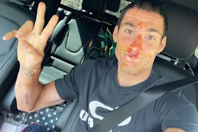 Mit dem Mountain Bike gestürzt: Aleix Espargaró 