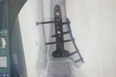 Michael van der Mark in Donington Park