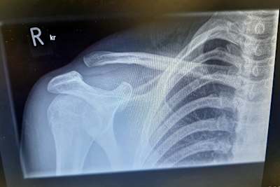 Ein Foto aus Schleiz