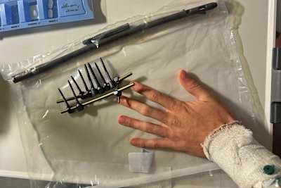 Flotter Gewichtsverlust