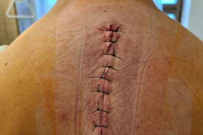 Ein neuer Reissverschluss am Rücken