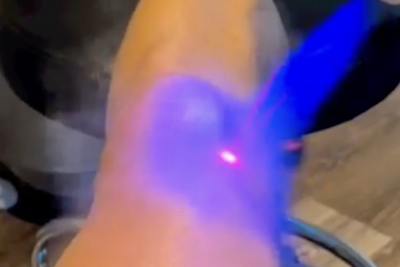 Ken Roczen bei seinen Rehabilitationsmaßnahmen