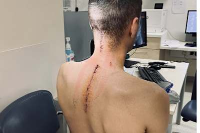 Michael Sandner nach der OP