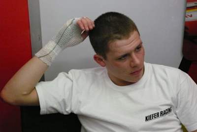 Stefan Bradl: Mittelhandknochen gebrochen?