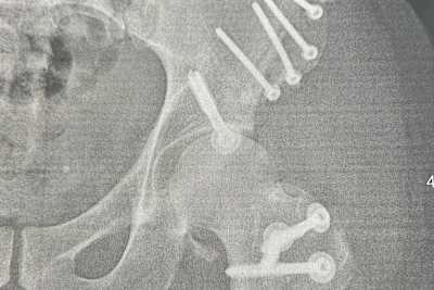 Der Kontrolltermin zeigte: Alle Schrauben sitzen gut