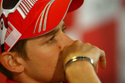 Ratlos: Casey Stoner