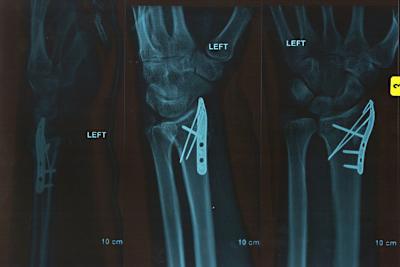 Die Hand von Chaz Davies