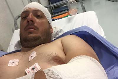 Andrea Petricca kam ohne Knochenbrüche davon