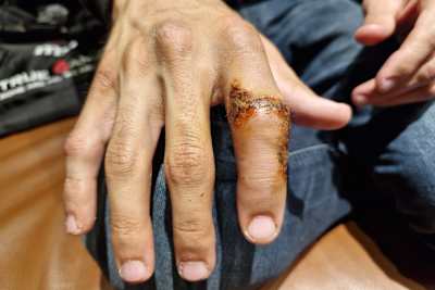 Der Zeigefinger an Toprak Razgatlioglus rechter Hand