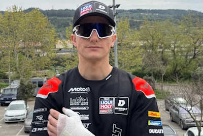 Wieder angeschlagen: Schlechter Auftakt für Weltmeister Hector Garzo